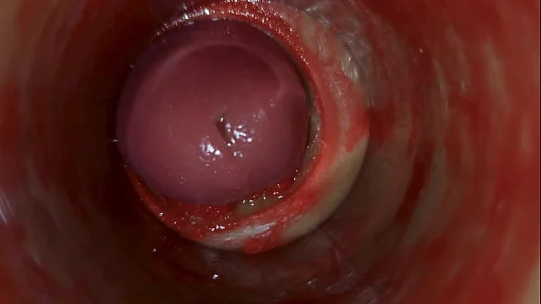 Camera Inside Deep Pussy Captures Huge Ejaculation of Sperm ASMR