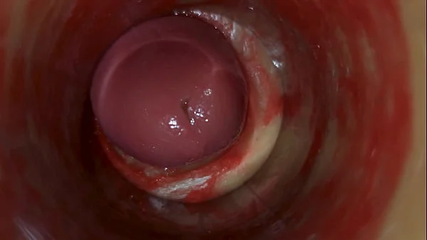 Camera Inside Deep Pussy Captures Huge Ejaculation of Sperm ASMR