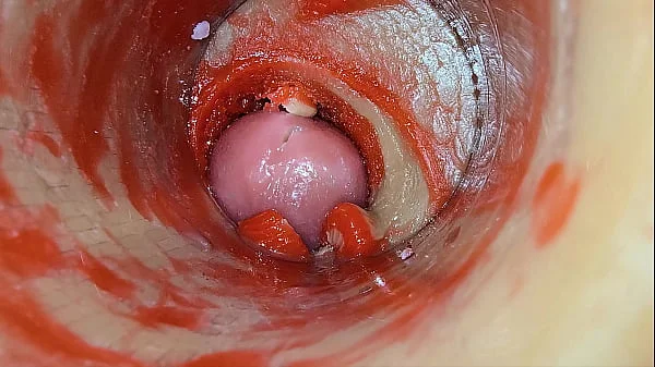 Camera Inside Deep Pussy Captures Dose Ejaculation of Sperm ASMR