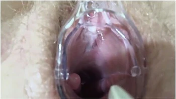 Mature Lesbians Play In A Gynecologist, Open The Vagina With A Medical Dilator, Examine The Cervix