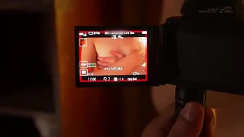 047-youth-with-areare-dmf