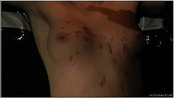 Short Hair Teen 18+ Gets Candle Wax On Her Tits And Endures Bdsm With Coco De Mal